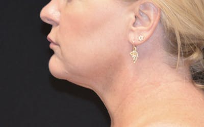there is a woman side profile