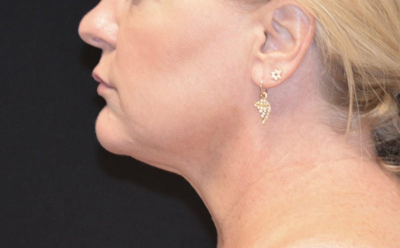 there is a woman side profile