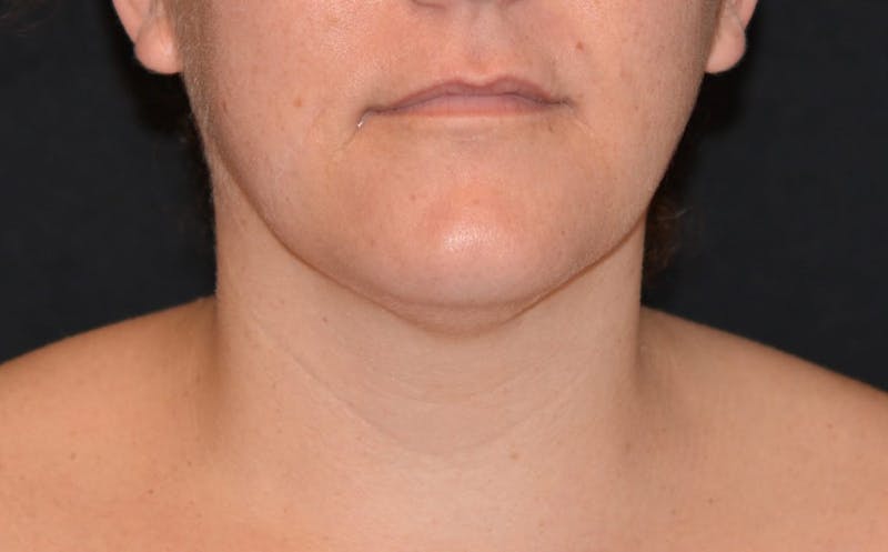 woman's neck