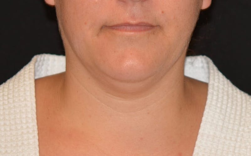 there is a woman with a white shirt and a black background