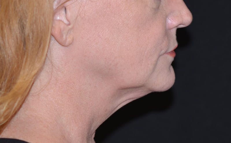 a close up of a woman with a red hair and a black shirt