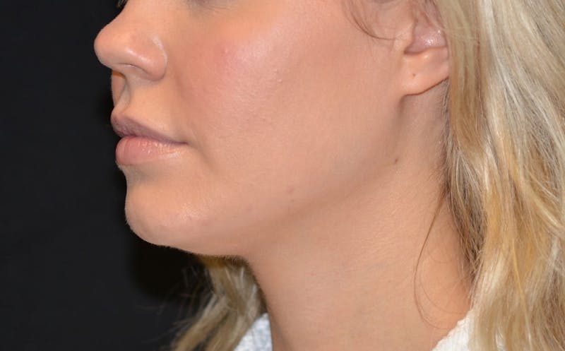 blond woman with a white shirt and a black background