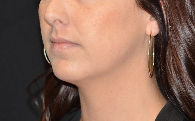 there is a woman with a pair of earrings on her neck