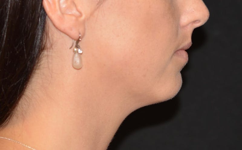 there is a woman with a necklace and earrings on her neck