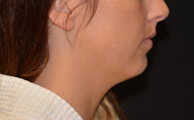 there is a woman with a white shirt and a black background