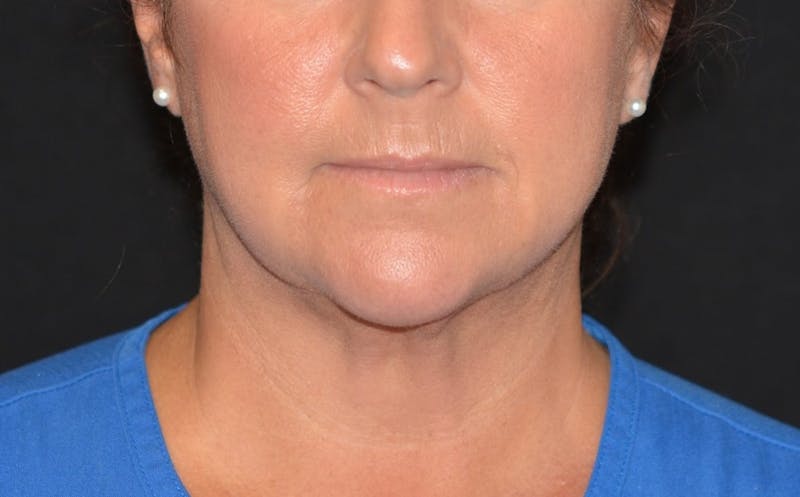 a close up of a woman with a blue shirt and a black background
