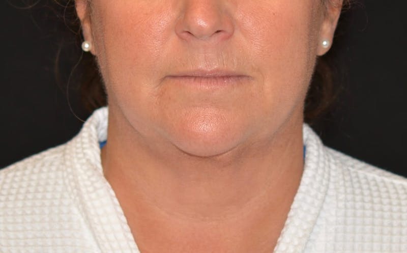 there is a woman with a white shirt and a black background