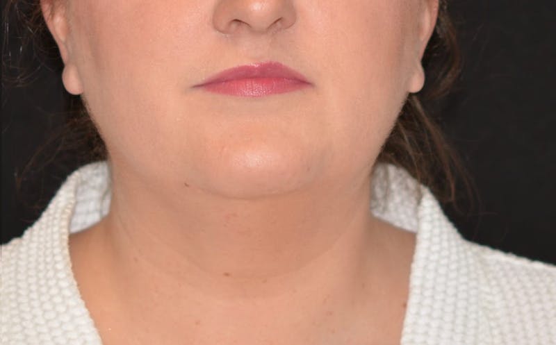 there is a woman with a white shirt and a black background
