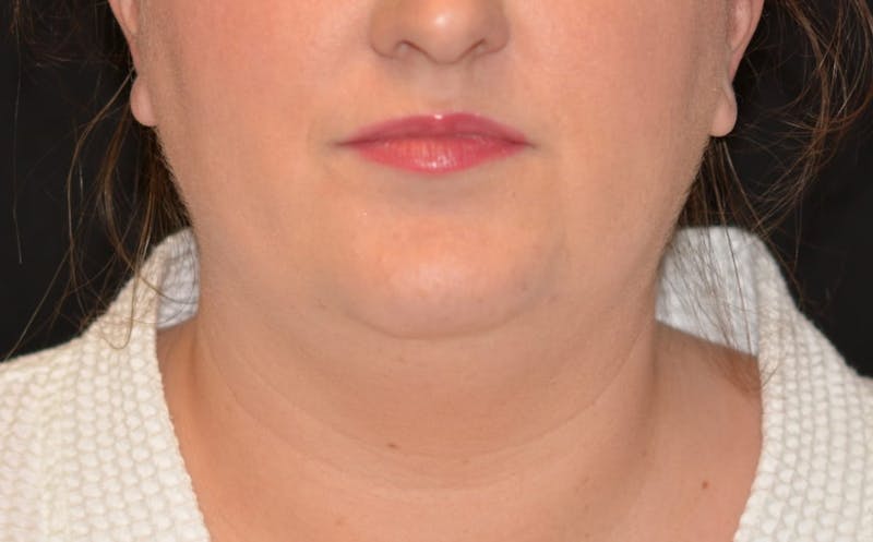 there is a woman with a white shirt and a necklace