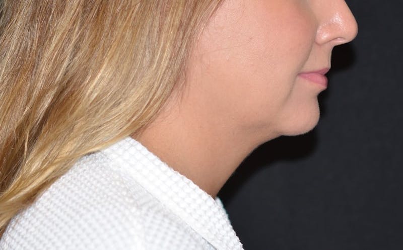 there is a woman with a white robe and a black background