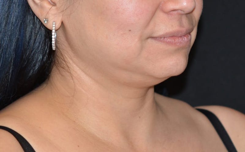there is a woman with earrings on her neck