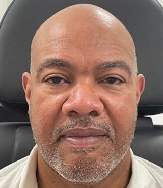 a close up of a man sitting in a chair with a bald head