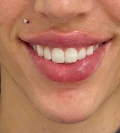 there is a woman with a piercing on her nose and a smile