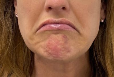 woman with a very large, swollen face