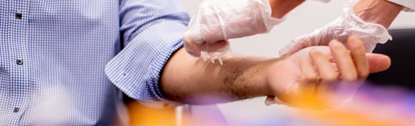 person undergoing allergy testing