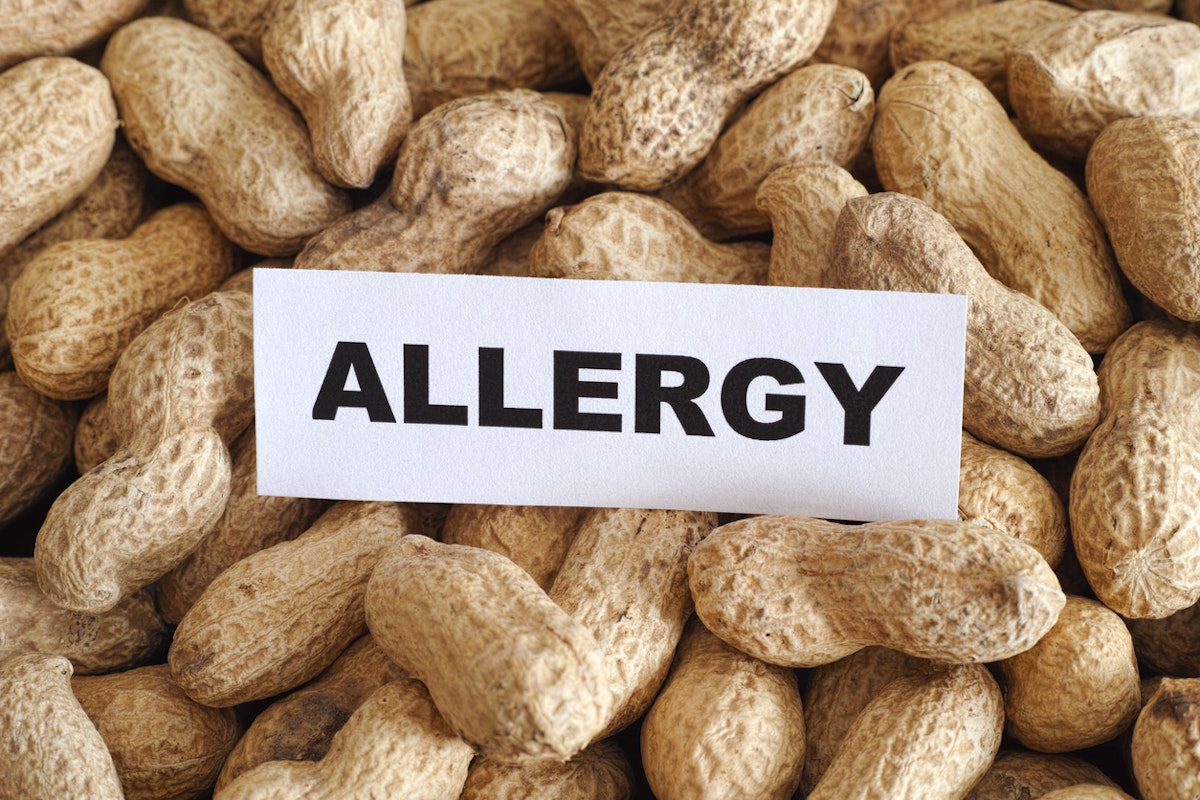 FSA advises anyone with a peanut allergy to avoid all foods containing