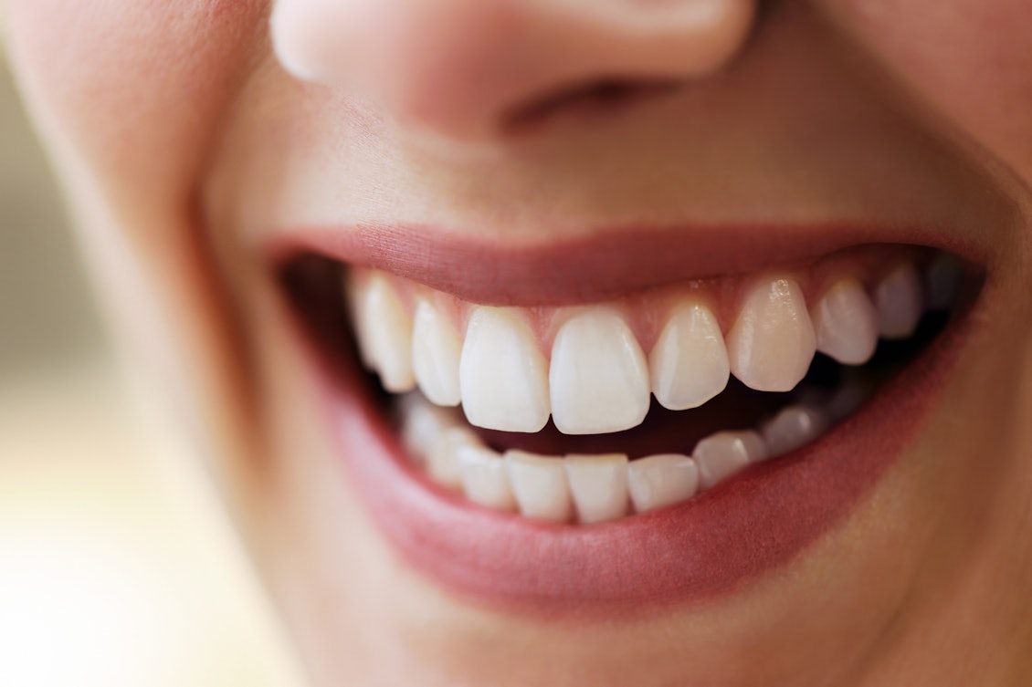 Frau lächelt mit strahlend weißen Zähnen