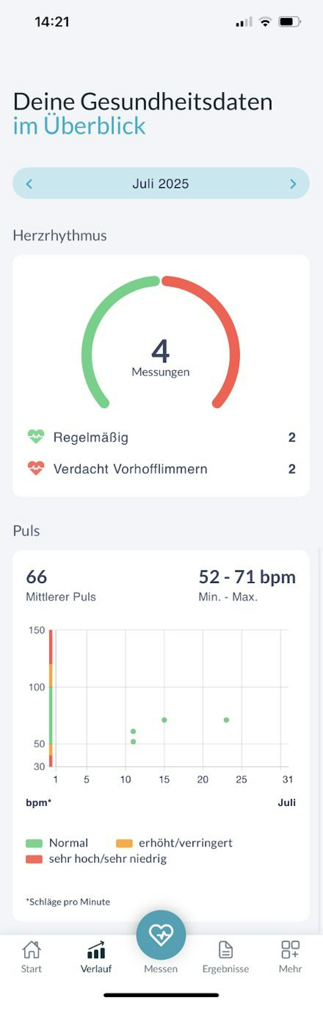 Screenshot von Gesundheitsdaten von Preventicus