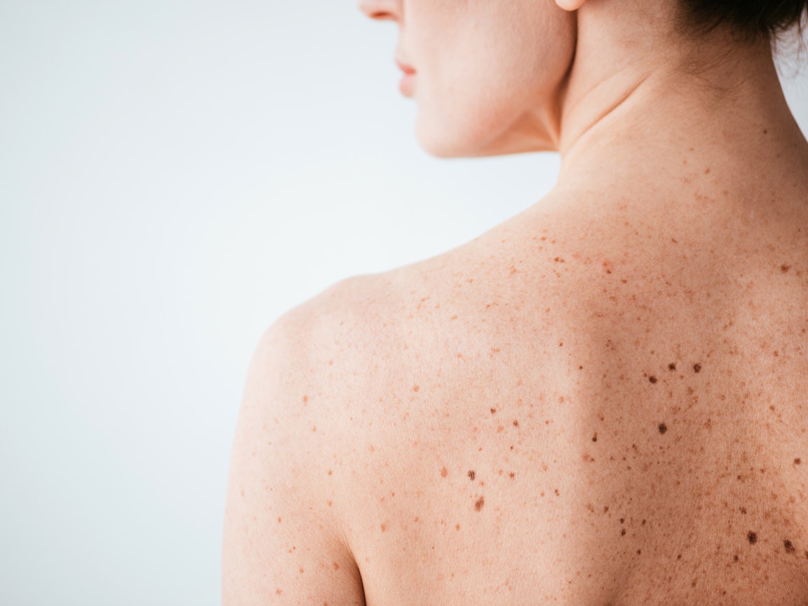 Haut/Rücken einer Frau Haut Schulterpartie einer jungen Frau