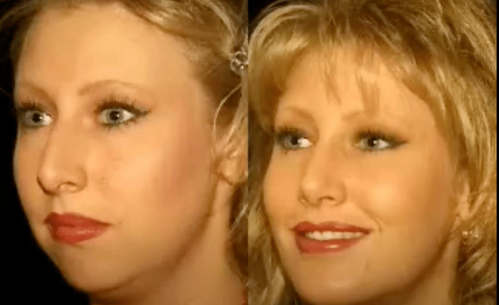 before and after photo