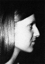 Dynam Columella Strut Dynam Columella Strut