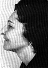 Dynam Columella Strut 3 Dynam Columella Strut 3