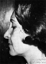 Dynam Columella Strut 4 Dynam Columella Strut 4