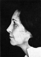 Dynam Columella Strut 5 Dynam Columella Strut 5