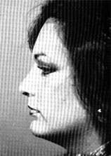 Dynam Columella Strut 10 Dynam Columella Strut 10