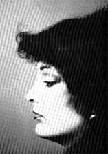 Dynam Columella Strut 11 Dynam Columella Strut 11