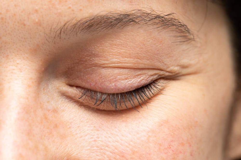 closed eye