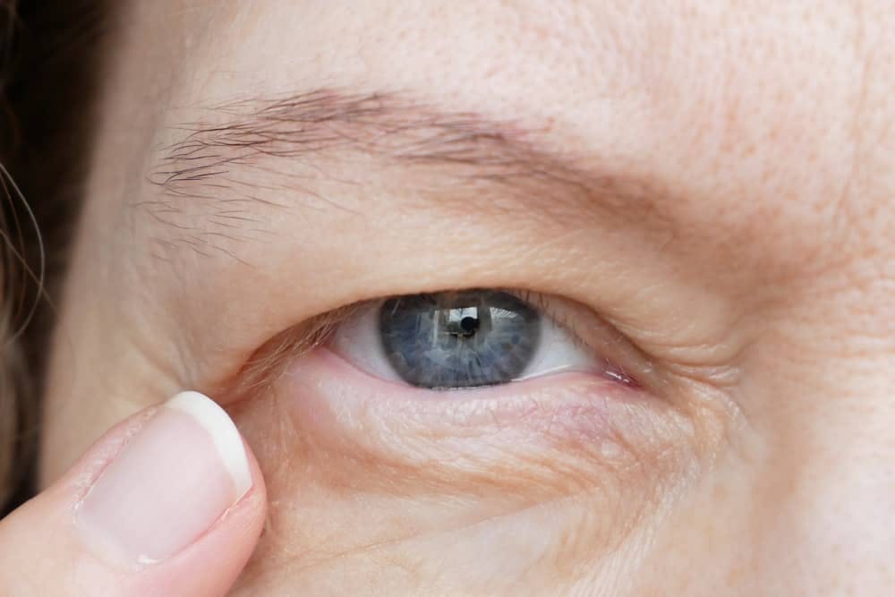 Glasgold Group provides Blepharoplasty as a definitive solution for hooded eyes and achieve your desired facial aesthetic