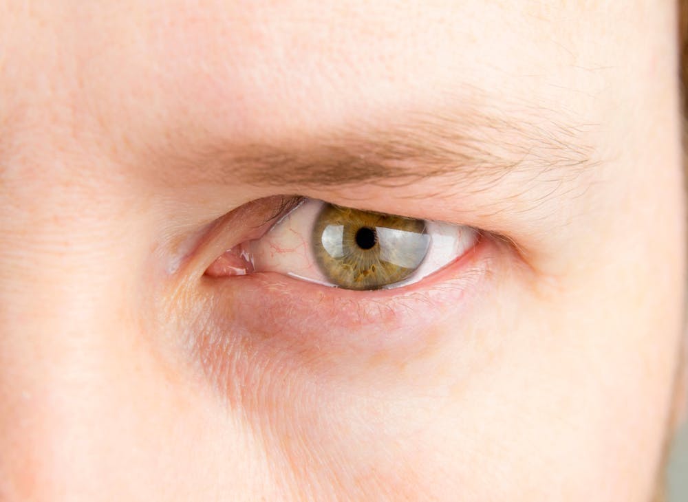 Glasgold Group provides extra safe and outstanding blepharoplasty results for all hooded eyed patients.
