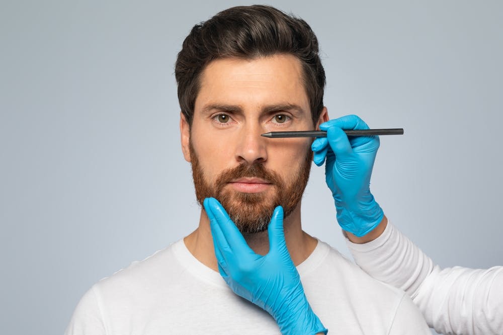 Male patients have different aesthetic goals and reasons to approach a revision rhinoplasty surgery, learn more with Glasgold Group experts on this article