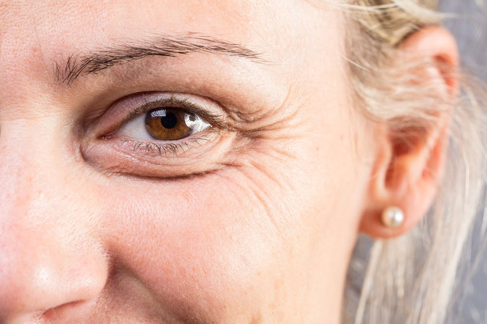 Though enhancing the eyes, blepharoplasty carries risks like other cosmetic procedures, warranting a closer look at potential complications.