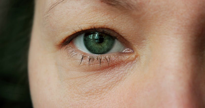 Lower blepharoplasty revives the eye area, diminishing fine lines and sagging skin for a refreshed, youthful look in facial rejuvenation