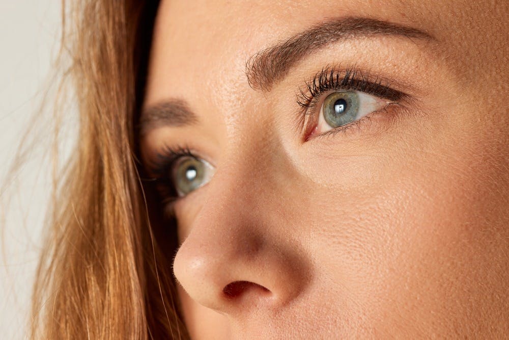 Close-up of botox results