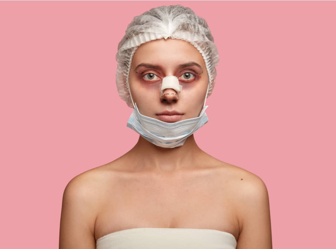 rhinoplasty patient