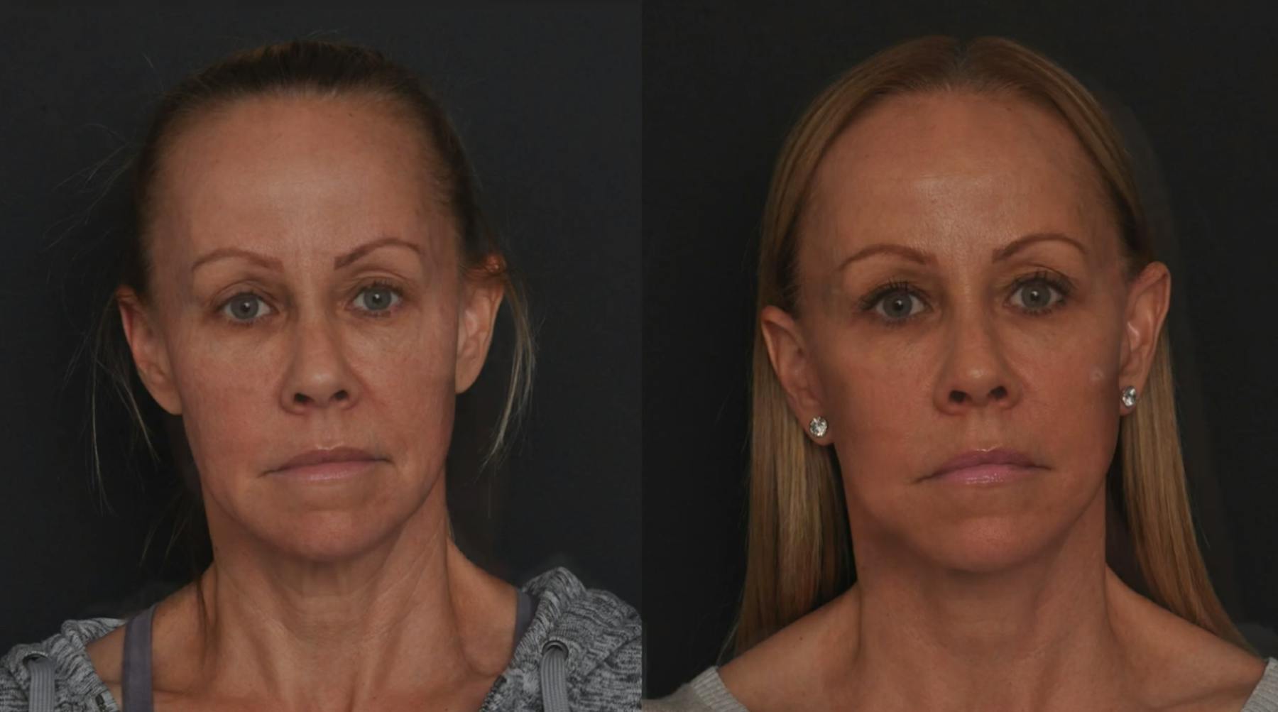 Glasgold Group Plastic Surgery