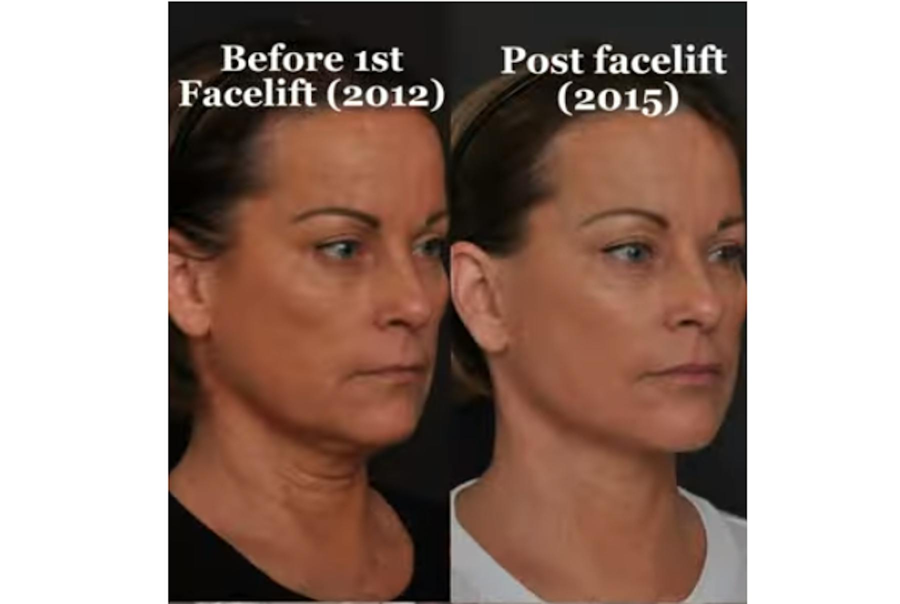 Glasgold Group Plastic Surgery