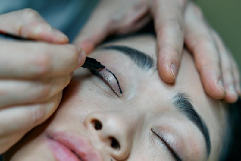 preoperative marking on woman's eyes