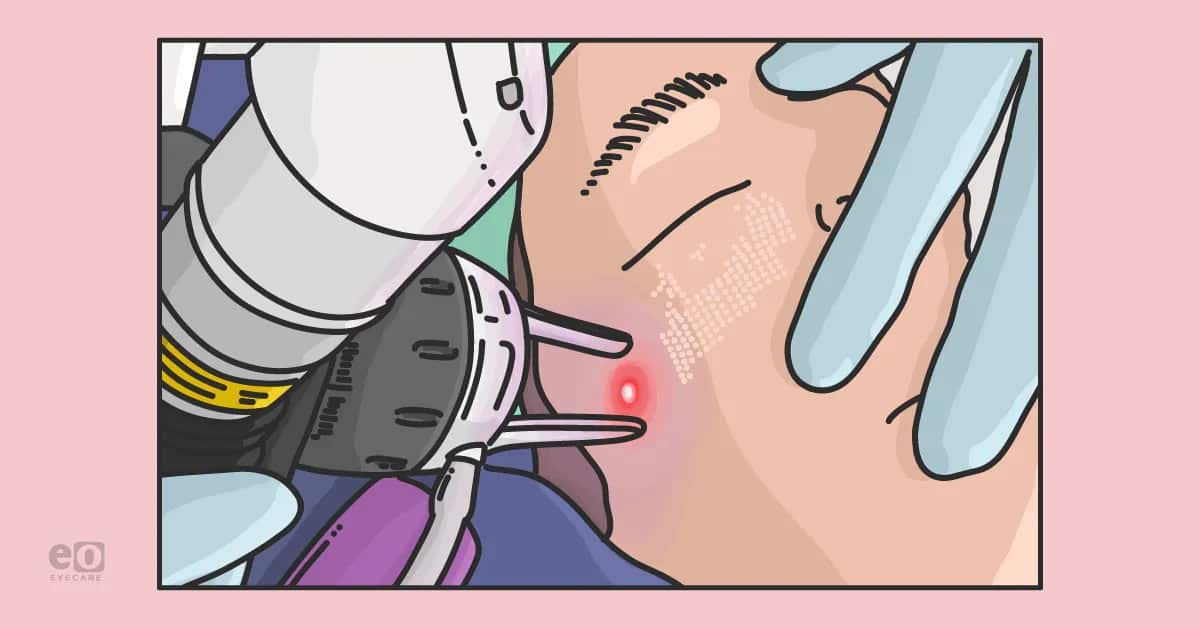 5 Clinical Pearls for Blepharoplasty