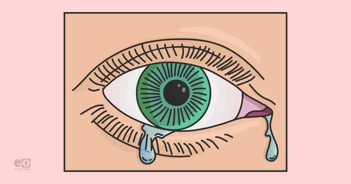 Dacryocystorhinostomy (DCR): Tips and Tricks for Residents