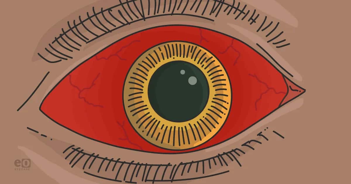 3 Major Complications in Oculoplastics Surgery Residents/Fellows Should Know