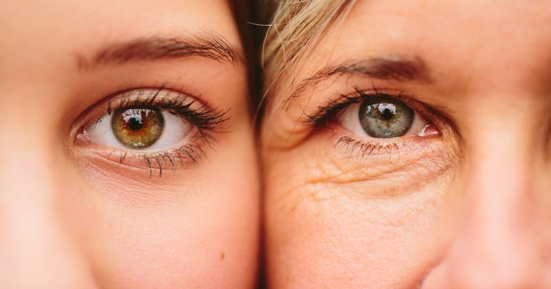 two women side by side zoomed into the eys. one has tight skin, the other has loose skin around the eyes