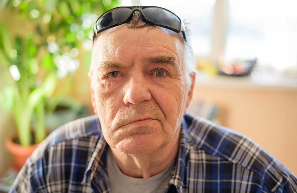  People suffering from Ramsay Hunt Syndrome may experience hearing loss or facial pains, which are caused by inflammation of the temporal bone around the ear