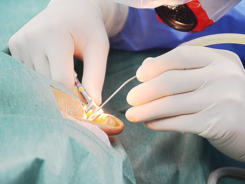 Before getting reconstructive ear surgery, research and evaluate potential surgeons, taking into account their experience and reputations