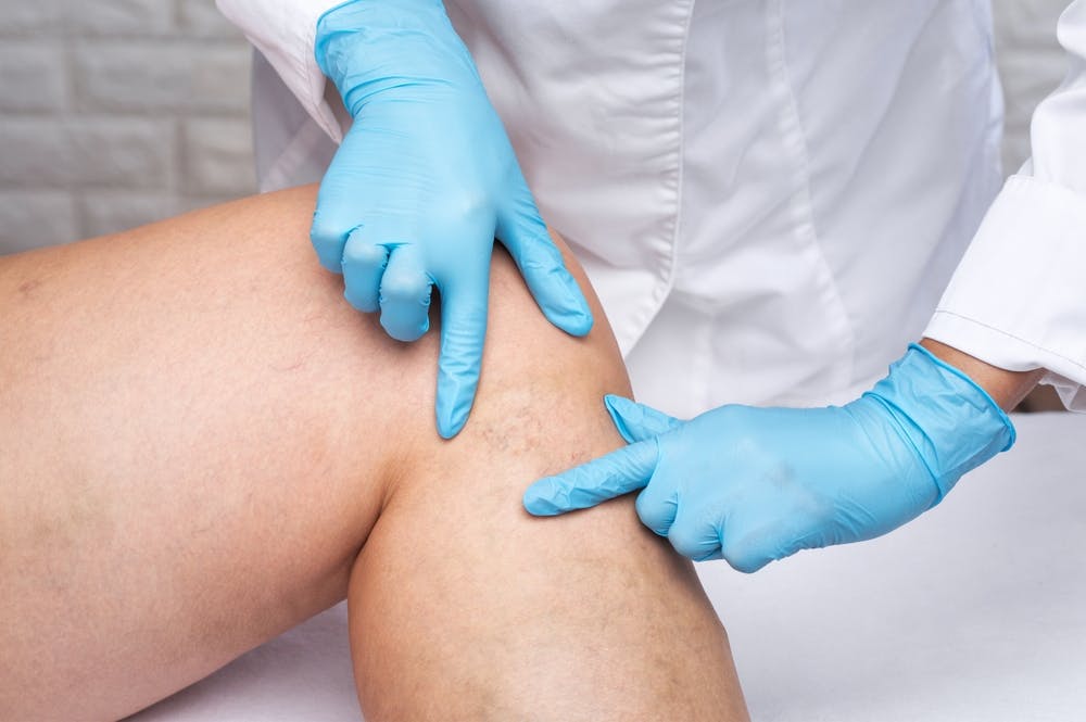 Venous malformations pose risks of clotting and infections due to stagnant blood flow, requiring prompt medical attention to prevent complications