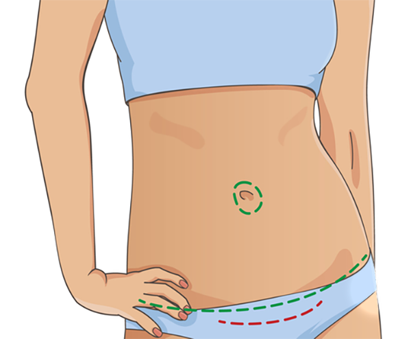 female abdomen illustration
