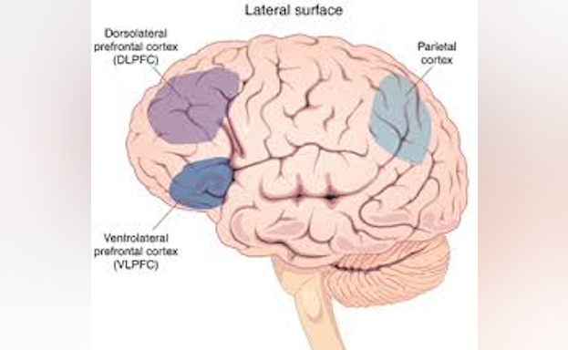 Brain Diagram Averill/Blumberg RC